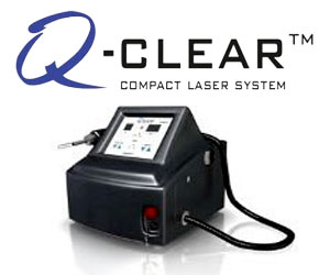 q-clear laser system