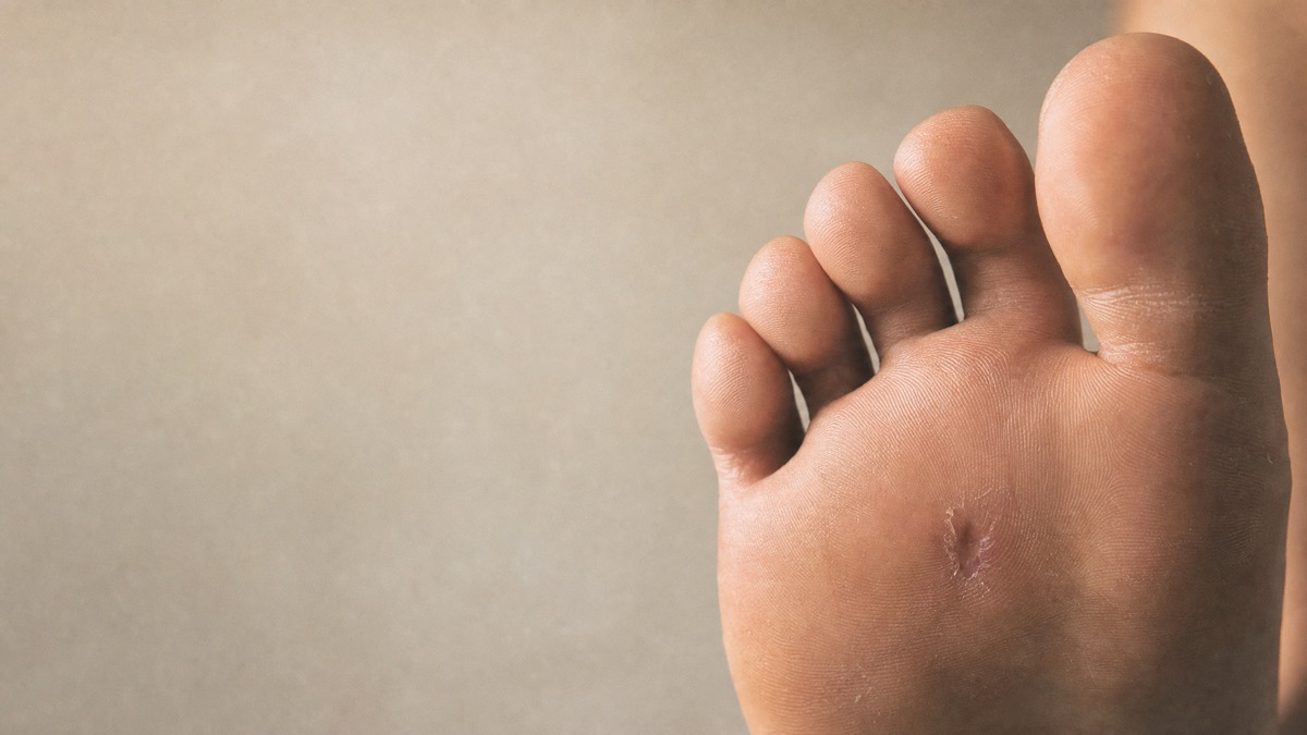Foot and ankle care at ASG Foot & Ankle