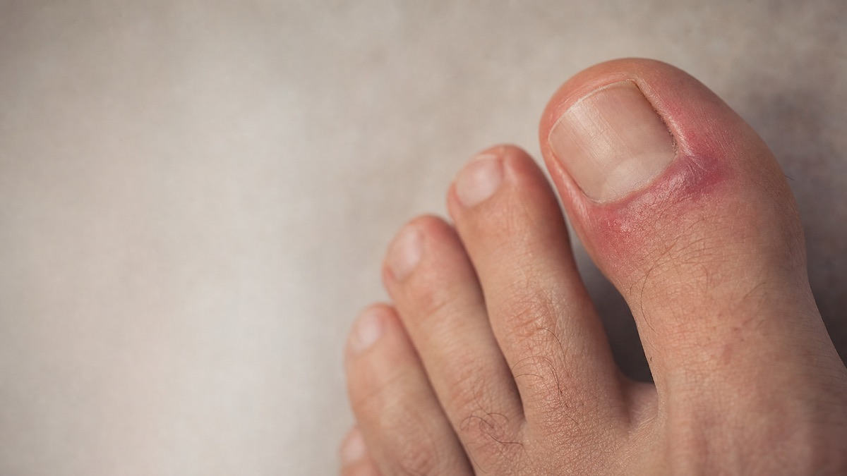 Foot and ankle care at ASG Foot & Ankle