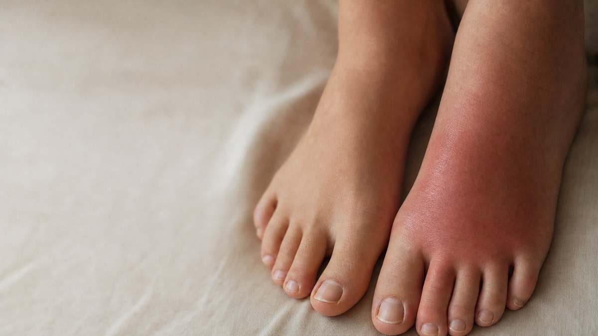 Foot and ankle care at ASG Foot & Ankle