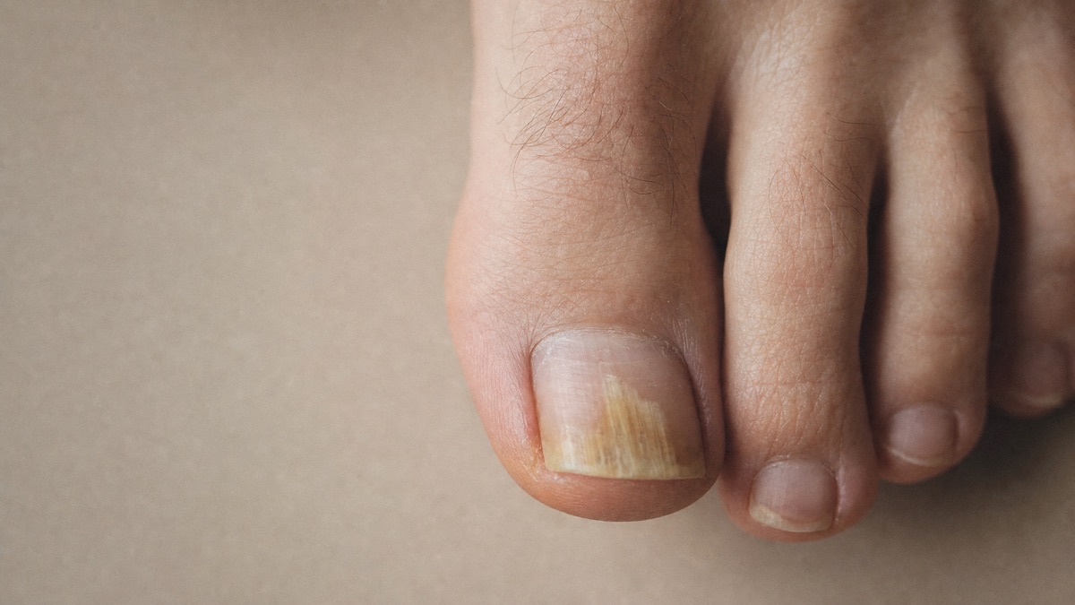 Foot and ankle care at ASG Foot & Ankle
