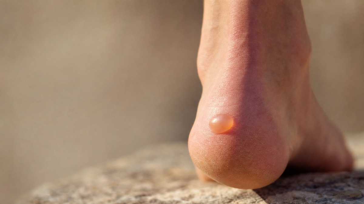 Foot and ankle care at ASG Foot & Ankle