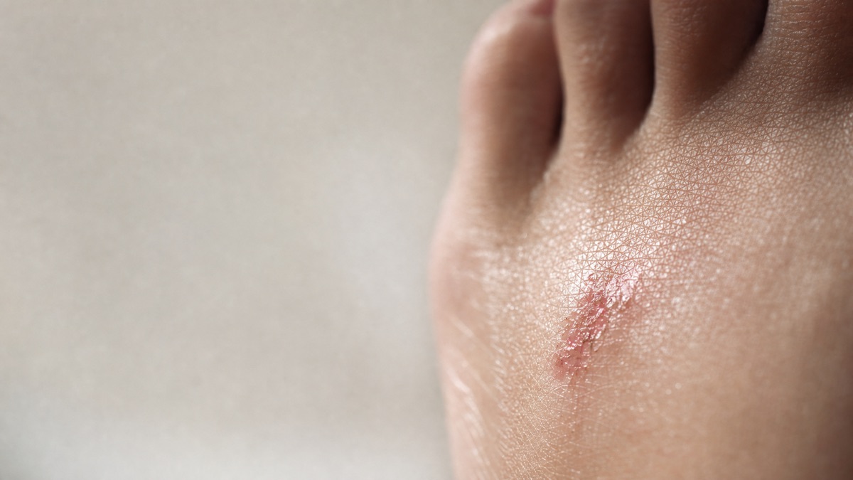 Foot and ankle care at ASG Foot & Ankle