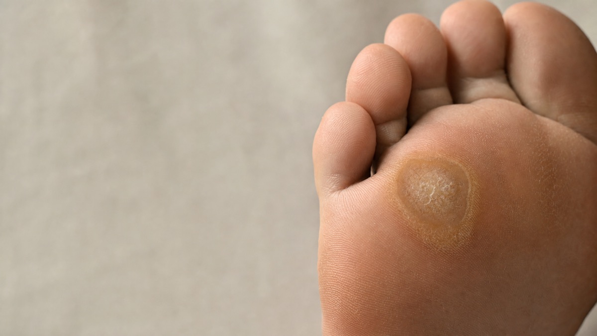 Foot and ankle care at ASG Foot & Ankle