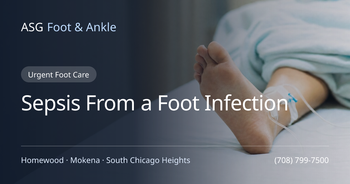 Sepsis From a Foot Infection: Warning Signs You Can't Ignore | ASG Foot ...